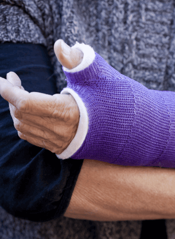 An arm wrapped in a cast 